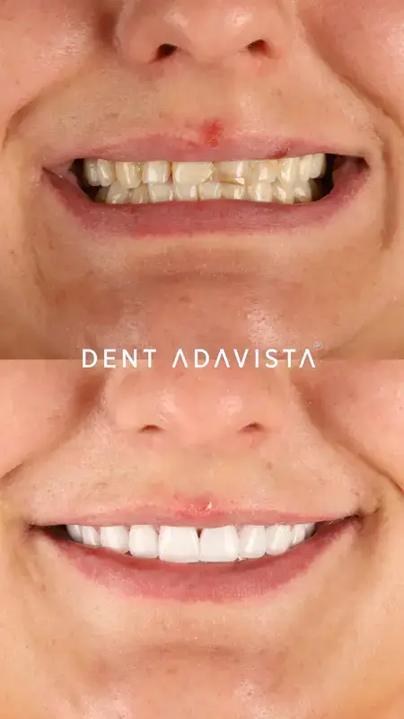 Adsız tasarım (12)