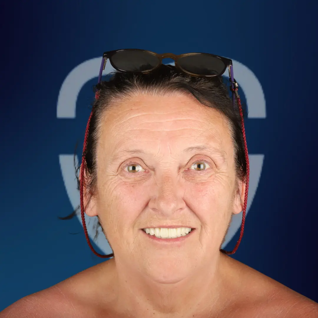 BA63