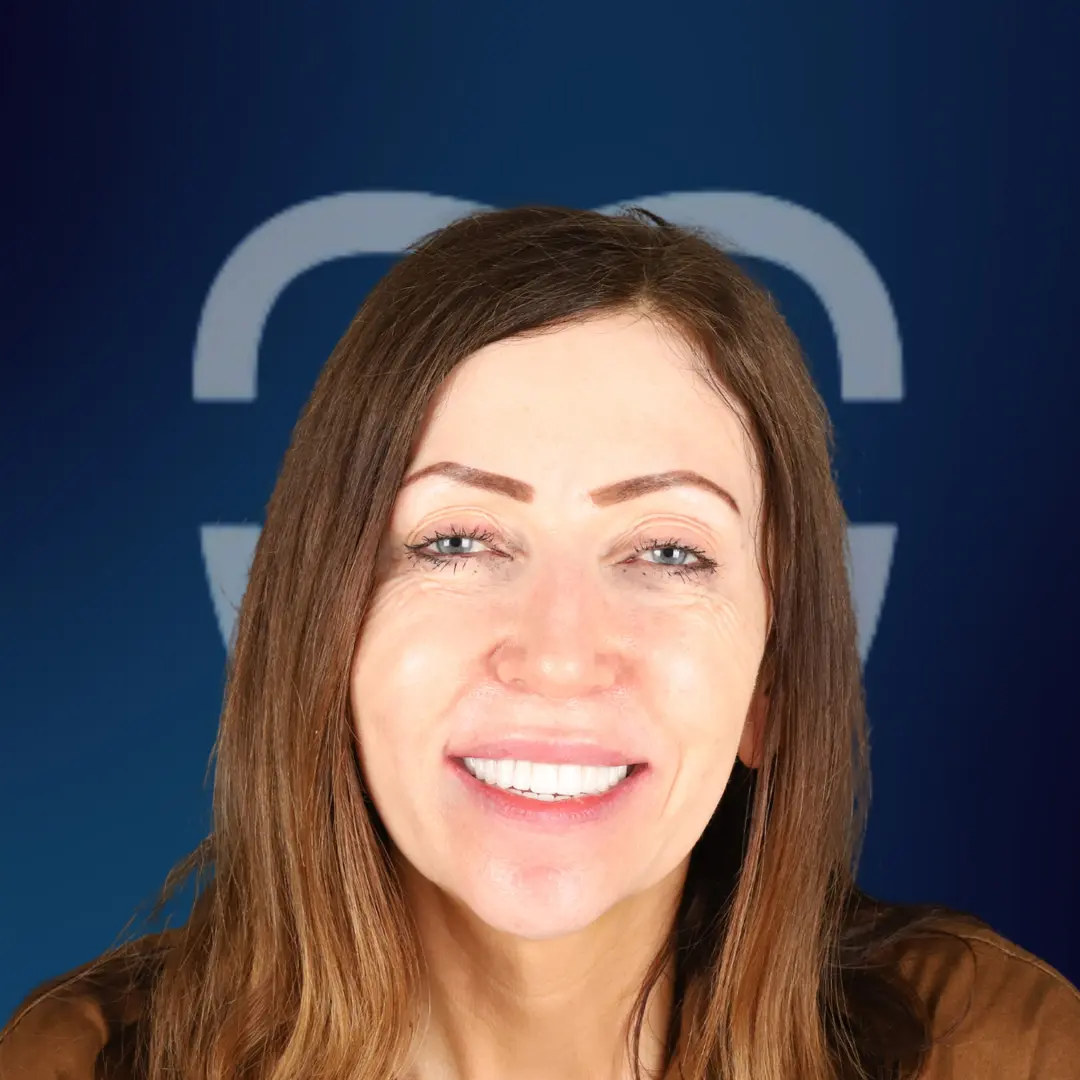 BA19