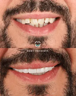 After treatment