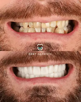 After treatment