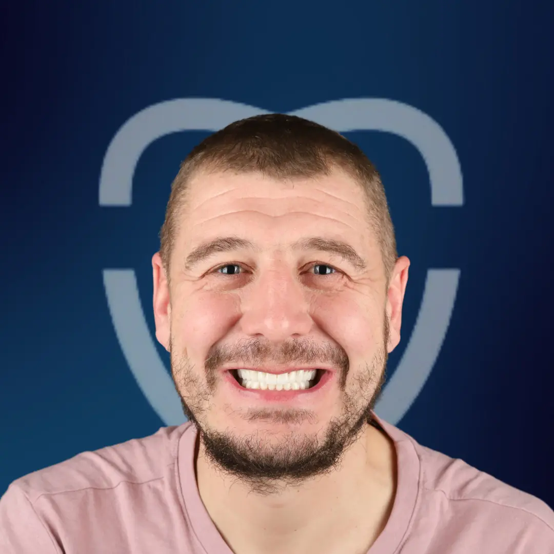 BA78