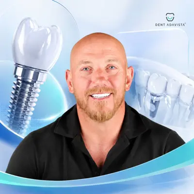 Implantes dentários