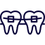 dental-braces